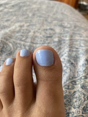 Lol what's good with these toes!! What are the dots.