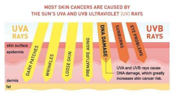 Chronic exposure to UVA rays through windows may  accelerate skin aging by 5 to 7 years. Get your windows tinted protect yourself!