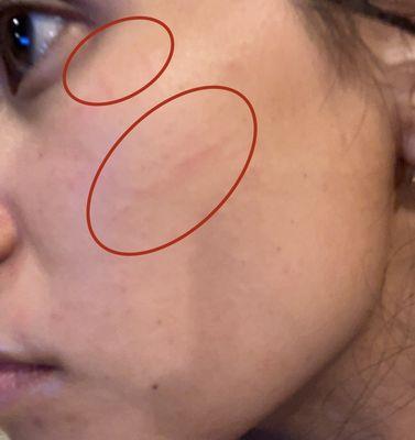 Circled cuts on the face. I had a few more on the other side.