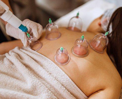 Offering Cupping Therapy.