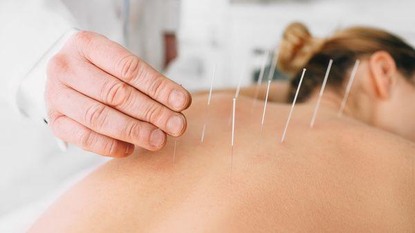 Acupuncture Xperts