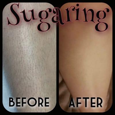 Sugaring legs before and after