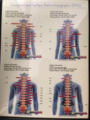 Ever new patient gets an EMG Muscle scan so we can see where your spinal issues are located.