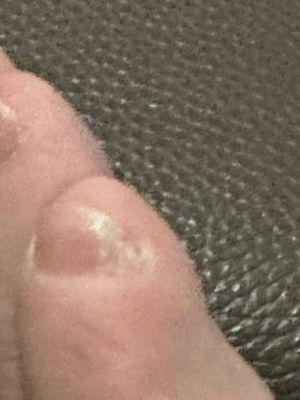 Baby toe nail not filed properly, kept snagging bed sheet.