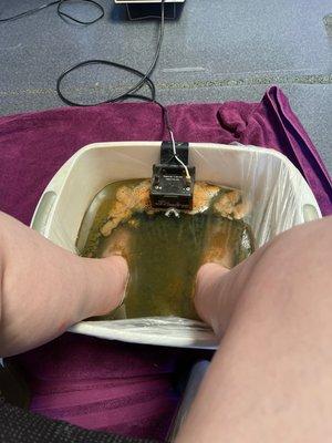 Detoxing with an ion detox foot bath! It's amazing!