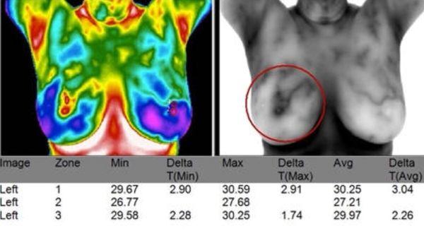 Thermography can reveal inflammation and processes acting on the body that other screening methods cannot.