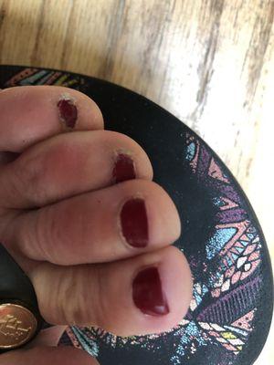 This is the day I got pedicure.  This is the after pic.  Terrible work