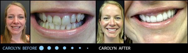 Carolyn's amazing before & after!