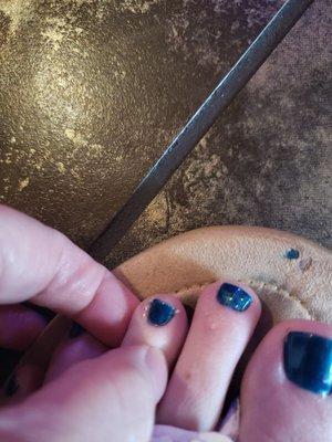 Untrimmed hang nails