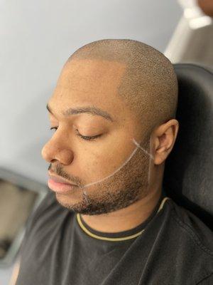 Lunar Scalp Micro Pigmentation