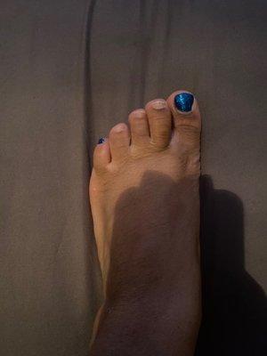 3 toes with polish completely gone after 6 days