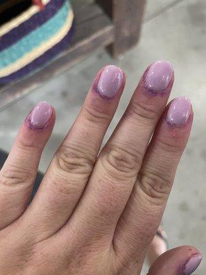 Ugly nails