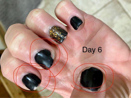 Chipping on almost all nails