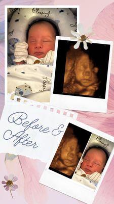 We absolutely LOVE before and afters. Don't forget to send us your babies photo once it's born so we can make one for you !