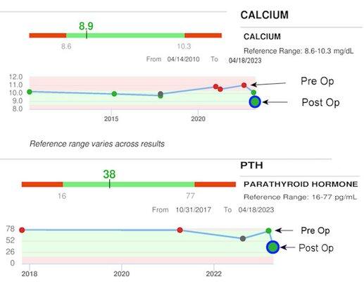 Labs before & after parathyroid surgery by Drs Brady & Sabra