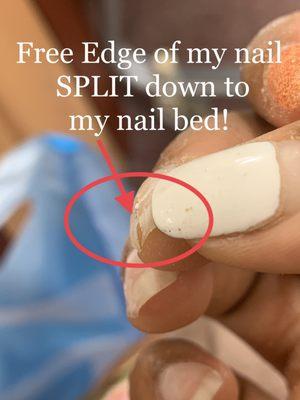 My nail was red, tender and throbbing!