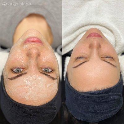 Dermaplaning + facial + mask