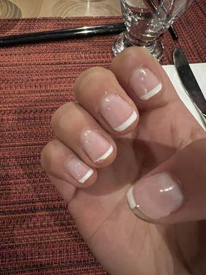 Chipped gel nails in 2 days