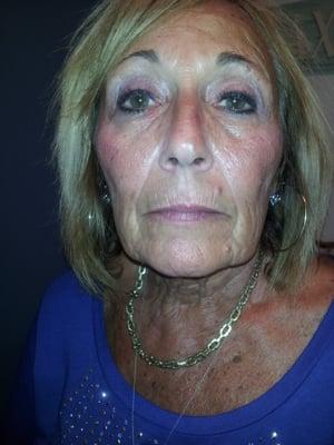 Permanent Makeup BEFORE-Lips