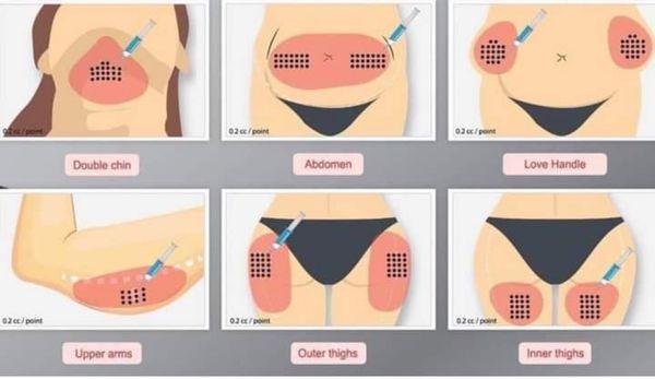 Reduction treatment, we only do cavitation and Lazer lipo, no needles.