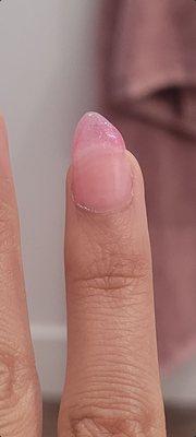 As you can see, it's a fresh nail. Shaping is very crooked.