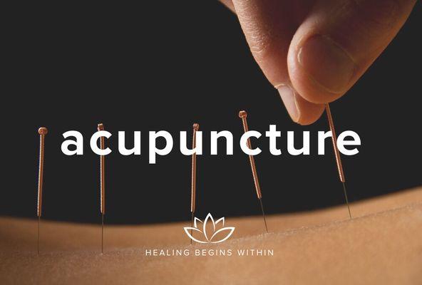 Acupuncture- many specific treatments.