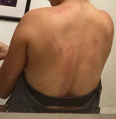 $90 massage that messed up my shoulder and back.