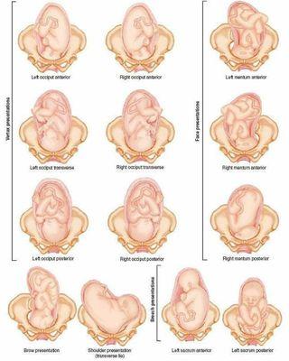 Positions of baby