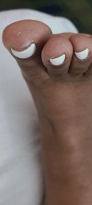 How toes look from pedicure. Paint everywhere. Not filed correctly on big toe.