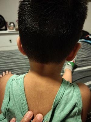 The unwanted bald streak that someone decided to shave on my 3 year old son. Why????