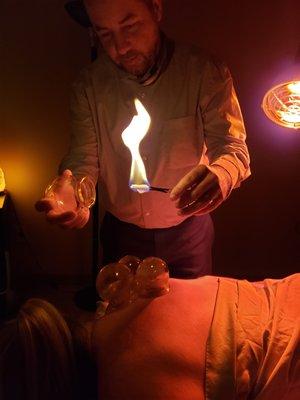 Fire cupping