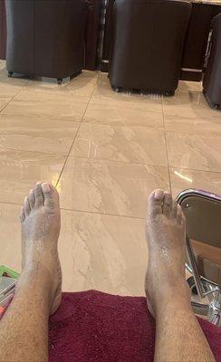 My feet that were scald by hot water at Luxury Nail & Spa