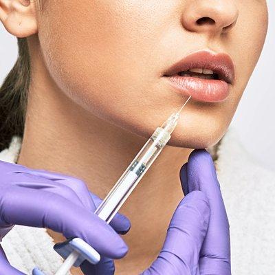 Dermal Fillers