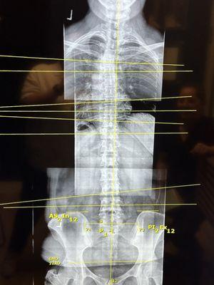 Front spinal view