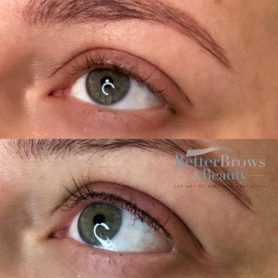 Lash line enhancement