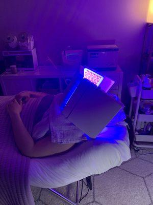 Blue LED light for Acne and clearing.