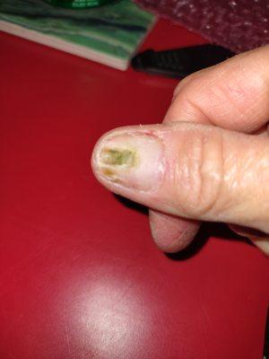 I have been here 3 times and all of my experiences have been great. Till today, I popped of a nail at work and what I saw was alarming!!