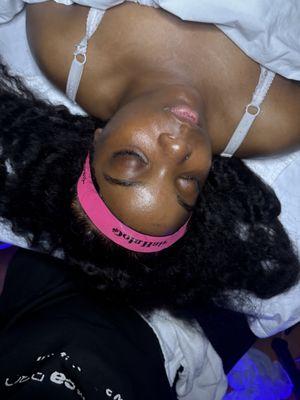 Specialty facial using Vaccum Machine