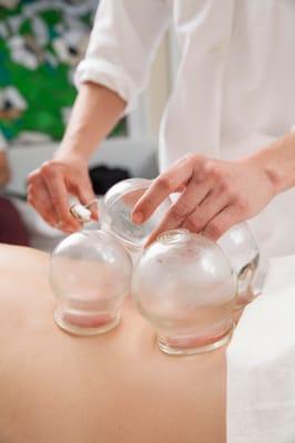 Cupping therapy works by expanding the capillaries and increasing the amount of fluid entering and leaving tissues to promote healing