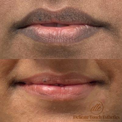 Healed Lips Blushed text 916 801 9859 by appointment only (online booking available)