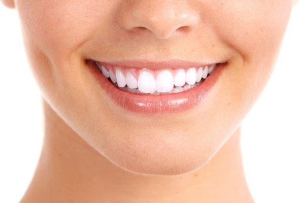 Teeth Whitening Available at Stony Brook Dental Care Louisville KY