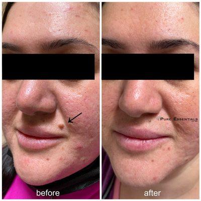 Corrective skin care tx