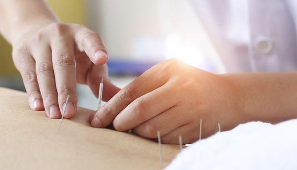 Acupuncture and Herbs are effective for a broad range of disorders.  It has a few side effects and can be a good alternative to drugs.