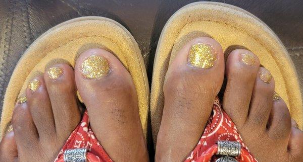 This is NOT what an $80 gel pedicure is supposed to look like