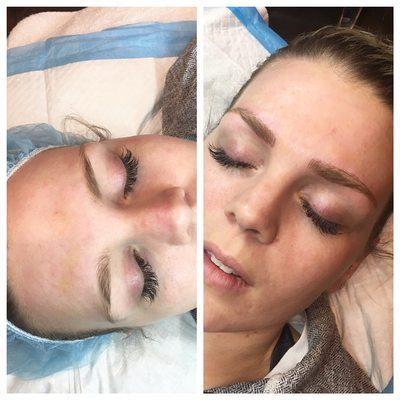 Before & after microblading eyebrows