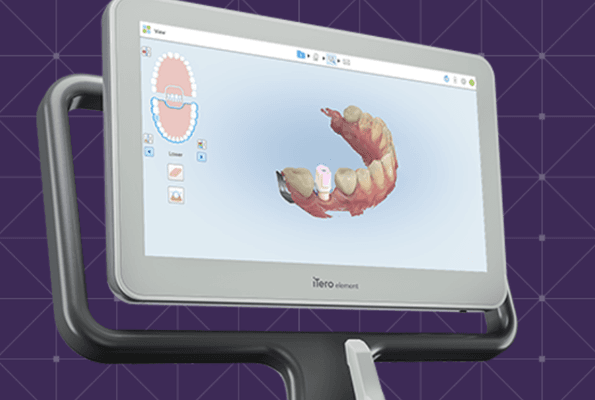 Scan instead of having mold !