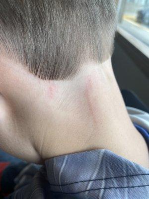 Small cuts on his neck and untrimmed hair