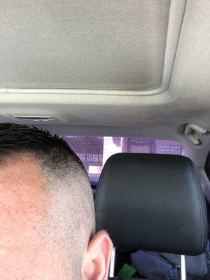 Skin fade