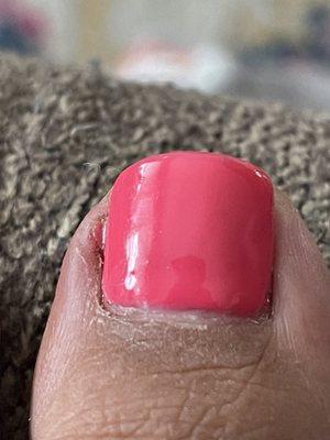 4 days after we got pedi .. my 60 dollar infection