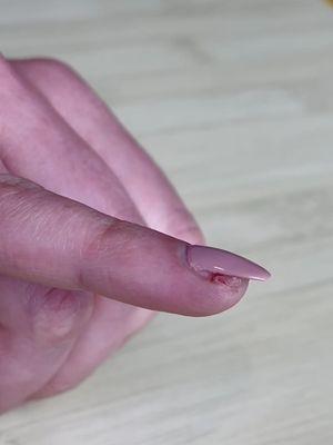 My sister's finger was cut by the nail artist.